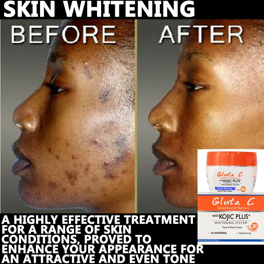 Gluta C with Kojic Acid Plus Glutathione Lightening Face & Neck Cream 25g
Gluta C with Kojic Acid Plus Glutathione Lightening Face & Neck Cream 25g