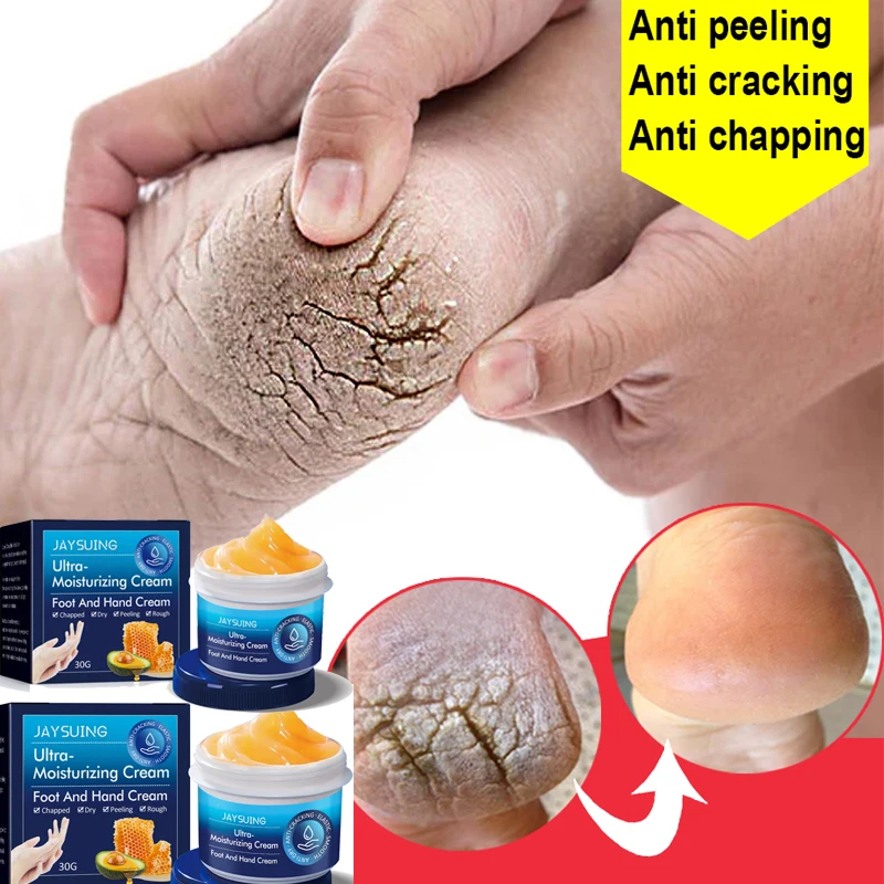 

30g Anti-Drying Crack Foot Hand Cream Heel Cracked Repair Hand Feet Mask Moisturizing Whitening Dead Skin Removal Skin Care