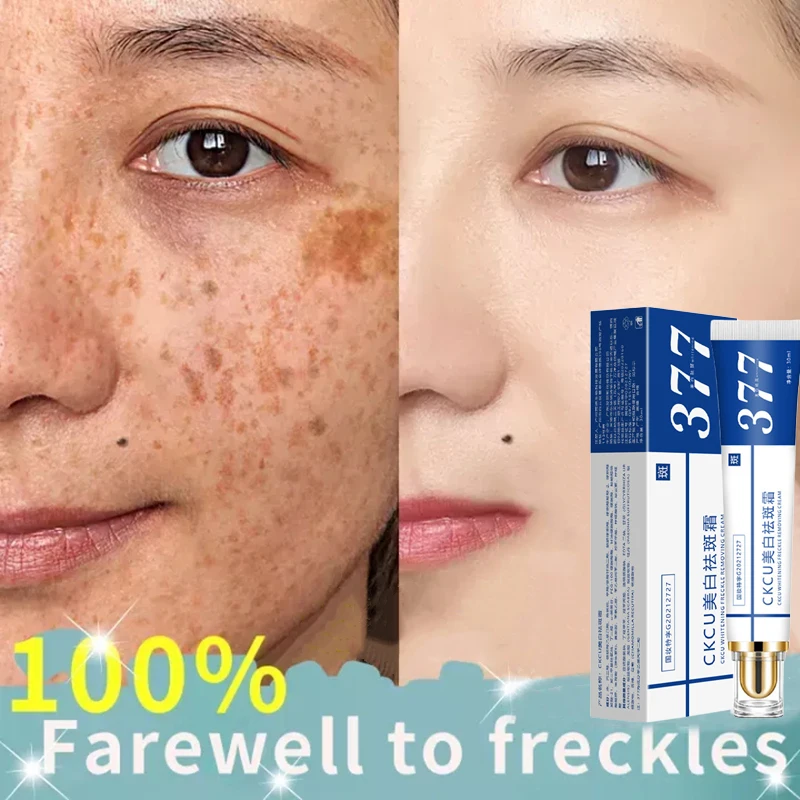 Effective Whitening Freckle Cream Remove Melasma Acne Spot Pigment Melanin Dark Spots Pigmentation Moisturizing Gel Skin Care
Effective Whitening Freckle Cream Remove Melasma Acne Spot Pigment Melanin Dark Spots Pigmentation Moisturizing Gel Skin Care