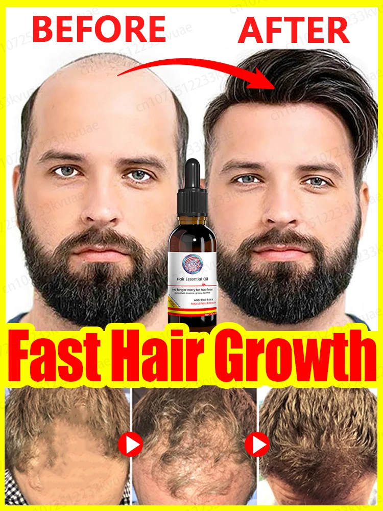 Hair Growth Oil Fast Hair Growth Effective Baldness Repair Hereditary Hair Loss Postpartum Hair Loss Seborrheic Hair Loss
Hair Growth Oil Fast Hair Growth Effective Baldness Repair Hereditary Hair Loss Postpartum Hair Loss Seborrheic Hair Loss