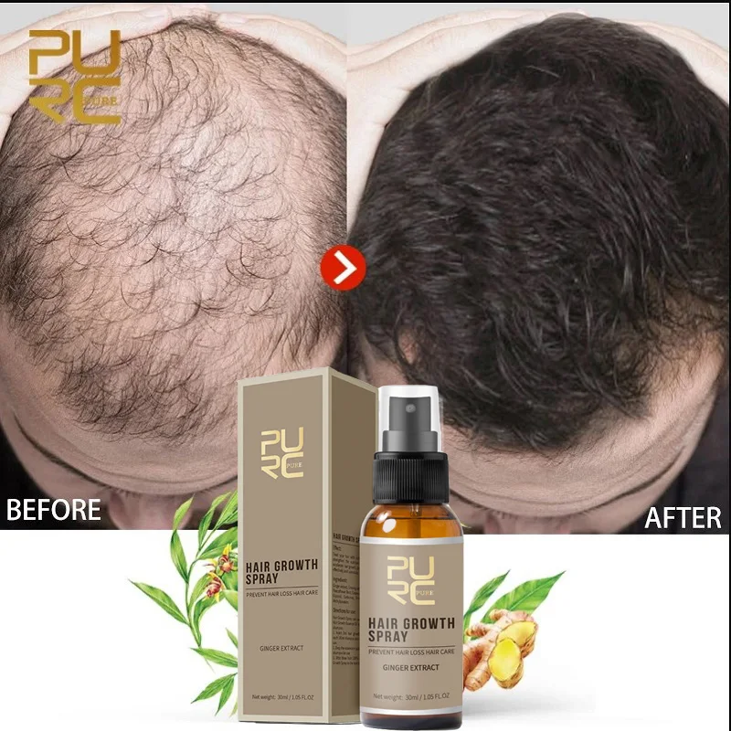 PURC Hair Growth Serum Spray Fast Growing Hair Oil Hair Loss Care Spray Hair Loss Nourish Root Hair Care Treatment 30ml
PURC Hair Growth Serum Spray Fast Growing Hair Oil Hair Loss Care Spray Hair Loss Nourish Root Hair Care Treatment 30ml