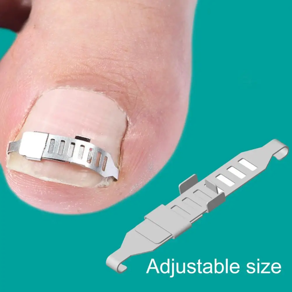 1 Set Toenail Grooves Pad Ergonomic Professional Stainless Steel Toenail Correction Lifter Tool for Home
1 Set Toenail Grooves Pad Ergonomic Professional Stainless Steel Toenail Correction Lifter Tool for Home