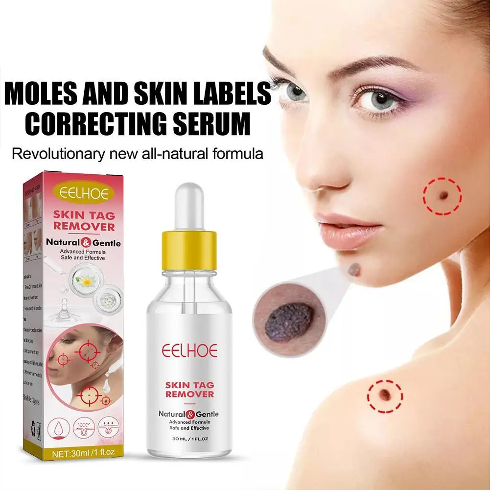 Super Luxe Skin Tag Remover Skin Tag Removal Mole Removal Mole Skin Serum Dark Spot Remover for Face and Body
Super Luxe Skin Tag Remover Skin Tag Removal Mole Removal Mole Skin Serum Dark Spot Remover for Face and Body