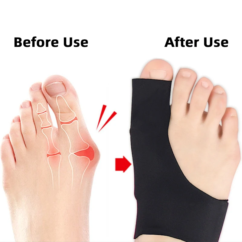 1Piece Hallux Valgus Sleeve Bunion Corrector Big Toe Foot Bone Separator Sock Thumb Adjuster Straightener Orthotic Appliance
1Piece Hallux Valgus Sleeve Bunion Corrector Big Toe Foot Bone Separator Sock Thumb Adjuster Straightener Orthotic Appliance