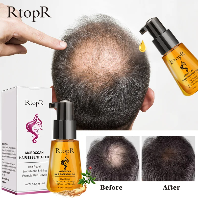 35ml Moroccan Prevent Hair Loss Oil Hair Growth Essential Easy To Carry Hair Care Mask Anti-Frizz Serum Nursing Repair Treatment
35ml Moroccan Prevent Hair Loss Oil Hair Growth Essential Easy To Carry Hair Care Mask Anti-Frizz Serum Nursing Repair Treatment