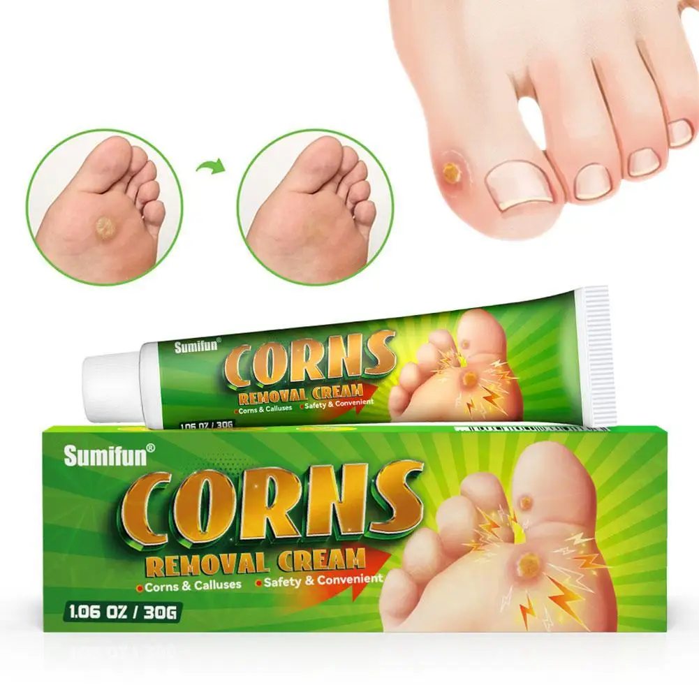 30g Net Weight Corn Ointment Care Ointment To Remove Calluses And Warts Smooth Ointment Foot Skin Care
30g Net Weight Corn Ointment Care Ointment To Remove Calluses And Warts Smooth Ointment Foot Skin Care