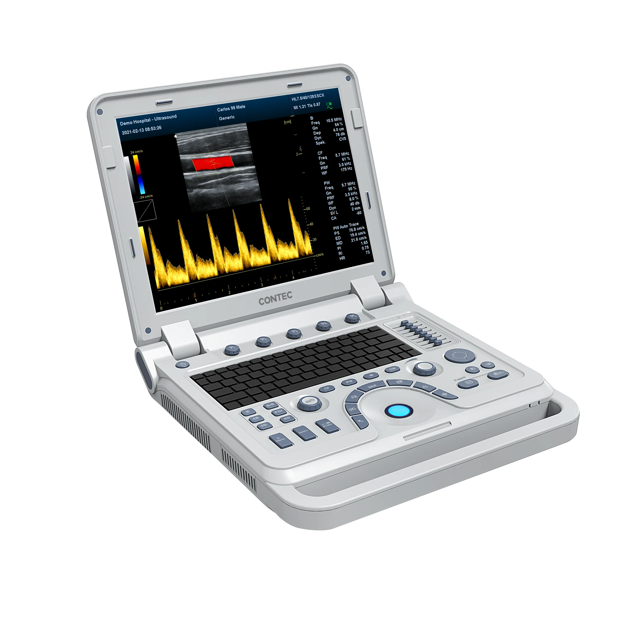 CONTEC CMS1700B Color Doppler USG Color Ultrasound Scanner Diagnostic Machine Systems Convex Probe
CONTEC CMS1700B Color Doppler USG Color Ultrasound Scanner Diagnostic Machine Systems Convex Probe
