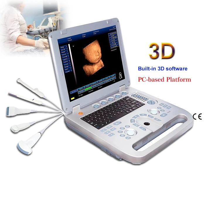 Portable medical ultrasound instruments ecography echo doppler ultrasound 3d gynecologic / pregnancy ultrasounds machine
Portable medical ultrasound instruments ecography echo doppler ultrasound 3d gynecologic / pregnancy ultrasounds machine