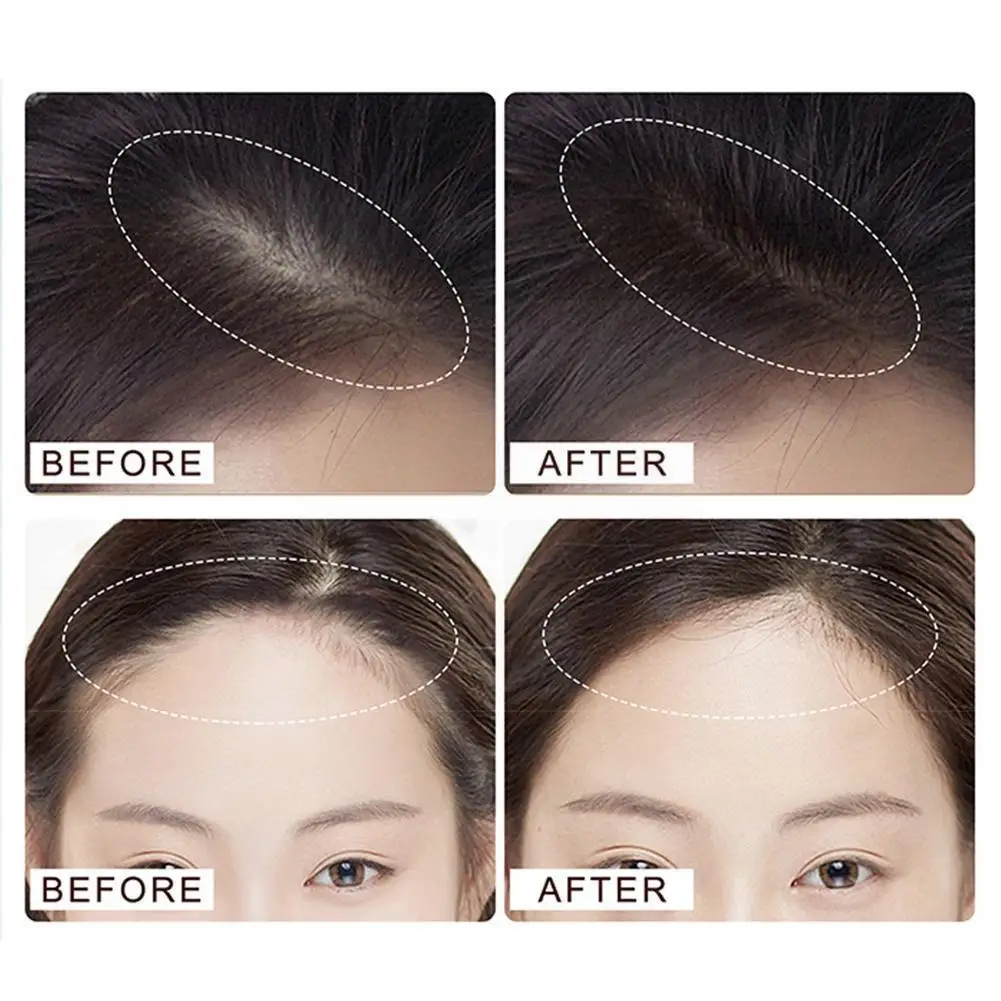 Hairline Trimming Hairline Concealer Powder Natural Hairline Hair Coverage Concealer Fluffy Hair Powder Instant Powder Shad R9X5
Hairline Trimming Hairline Concealer Powder Natural Hairline Hair Coverage Concealer Fluffy Hair Powder Instant Powder Shad R9X5