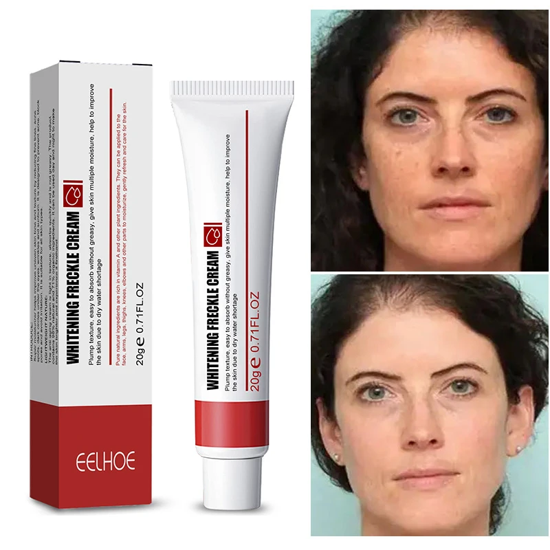 Whitening Freckle Removal Cream Dark Spot Treatment Fade Melanin Moisturizing Brighten Anti-aging Face Beauty Skin Care Products
Whitening Freckle Removal Cream Dark Spot Treatment Fade Melanin Moisturizing Brighten Anti-aging Face Beauty Skin Care Products