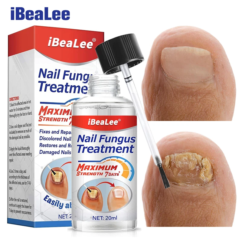 Эссенция для лечения грибка ногтей iBeaLee, 7 дней, уход за ногами, сыворотка для удаления грибка на ногтях, гель для удаления инфекции онихомикоза, ремонт
Эссенция для лечения грибка ногтей iBeaLee, 7 дней, уход за ногами, сыворотка для удаления грибка на ногтях, гель для удаления инфекции онихомикоза, ремонт