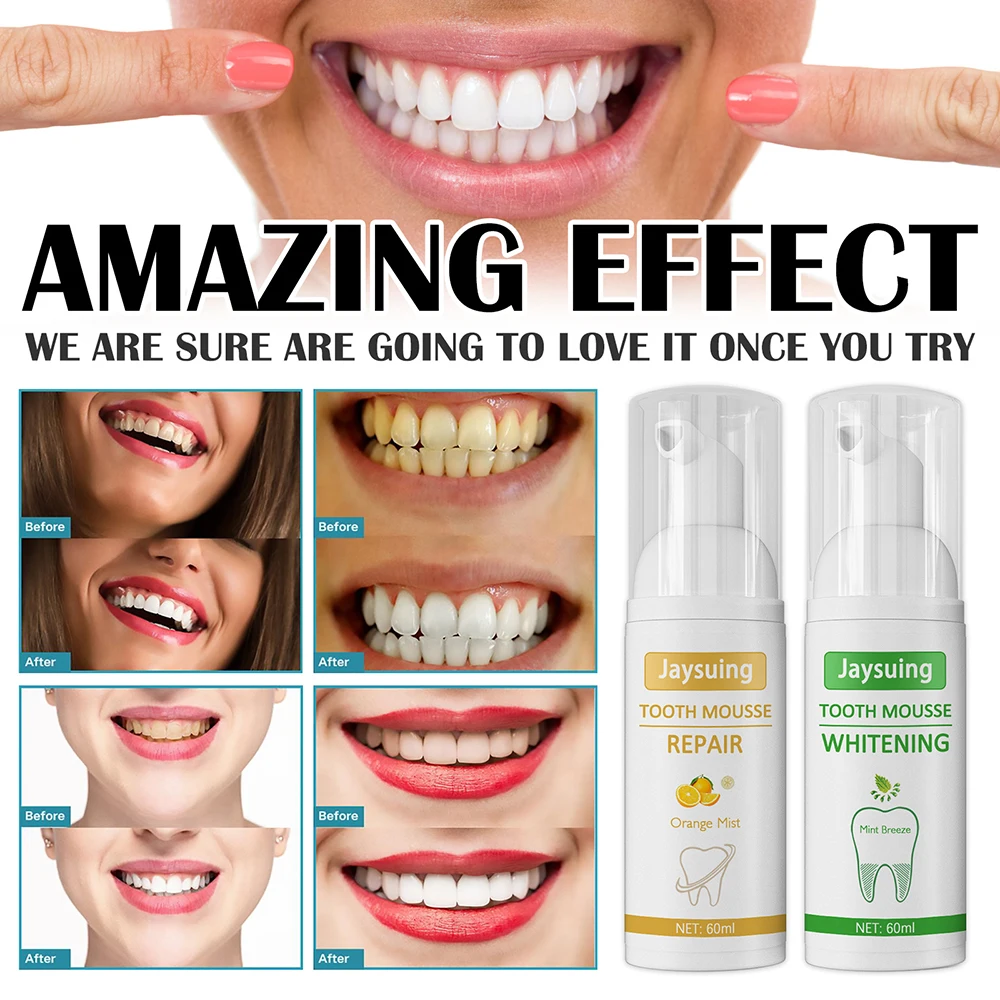 Tooth Whitening Repair Mousse Toothpaste Fresh & Mild Flavour Foaming Safe for Daily Use Whitening Treatment Efficient EIG88
Tooth Whitening Repair Mousse Toothpaste Fresh & Mild Flavour Foaming Safe for Daily Use Whitening Treatment Efficient EIG88