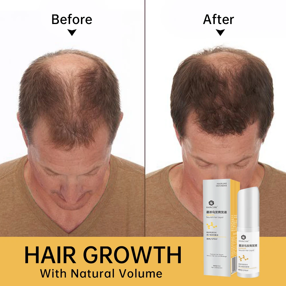 

Спрей для роста волос, эфирное масло против выпадения волос для мужчин и женщин, восстанавливает поврежденные корни волос, продукт для рост...
