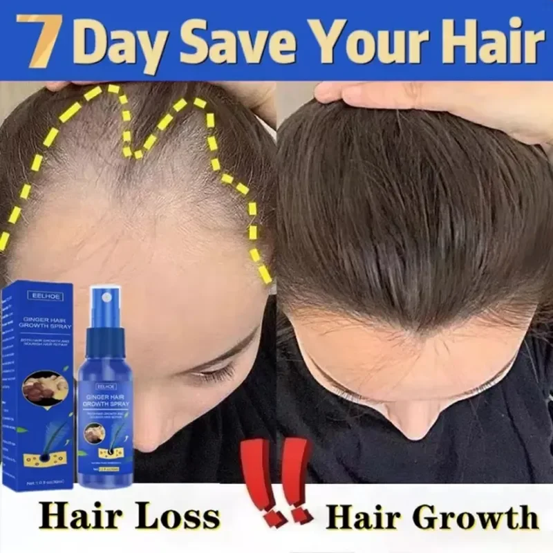 Ginger Hair Growth Liquid Stimulates Hair Follicles Promotes Growths Strengthen Hair Roots Prevent Hair Loss Treating Baldness
Ginger Hair Growth Liquid Stimulates Hair Follicles Promotes Growths Strengthen Hair Roots Prevent Hair Loss Treating Baldness