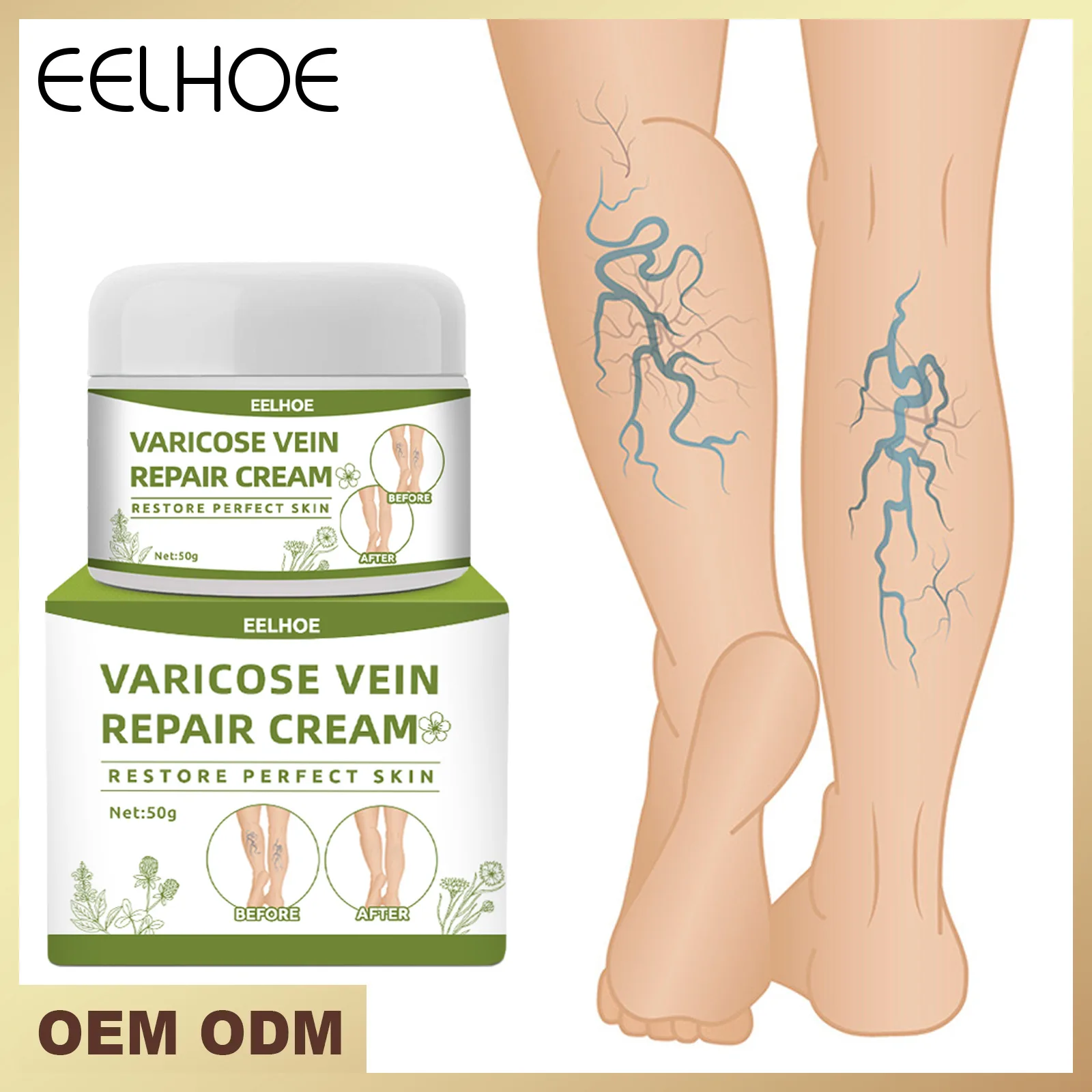 Varicose Vein Cream Leg Swelling Earthworm Leg Care Cream Leg Varicose Cold Compress Cream Venous Disorder Home Treatment Suit
Varicose Vein Cream Leg Swelling Earthworm Leg Care Cream Leg Varicose Cold Compress Cream Venous Disorder Home Treatment Suit