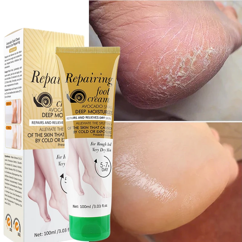 Foot Moisturizing Cream Exfoliator Dead Skin Remover Heel Cracked Dry Skin Feet Treatment Hand Feet Skin Care Beauty-Health 100g
Foot Moisturizing Cream Exfoliator Dead Skin Remover Heel Cracked Dry Skin Feet Treatment Hand Feet Skin Care Beauty-Health 100g