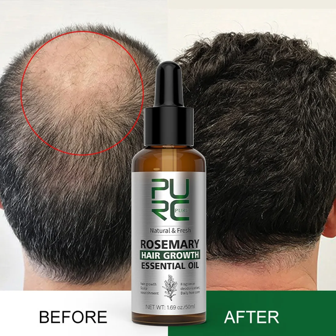 Rosemary Oil Hair Growth Products for Man Women Ginger Anti Hair Loss Fast Regrowth Thicken Oils Scalp Treatment Hair Care
Rosemary Oil Hair Growth Products for Man Women Ginger Anti Hair Loss Fast Regrowth Thicken Oils Scalp Treatment Hair Care