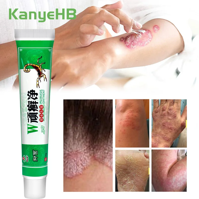 1Pcs Herb Psoriasis Treatment Ointment Chinese Medical Treat Tinea Pedis Ermatitis Eczematoid Anti-Itch Inhibit Fungi Cream S091
1Pcs Herb Psoriasis Treatment Ointment Chinese Medical Treat Tinea Pedis Ermatitis Eczematoid Anti-Itch Inhibit Fungi Cream S091