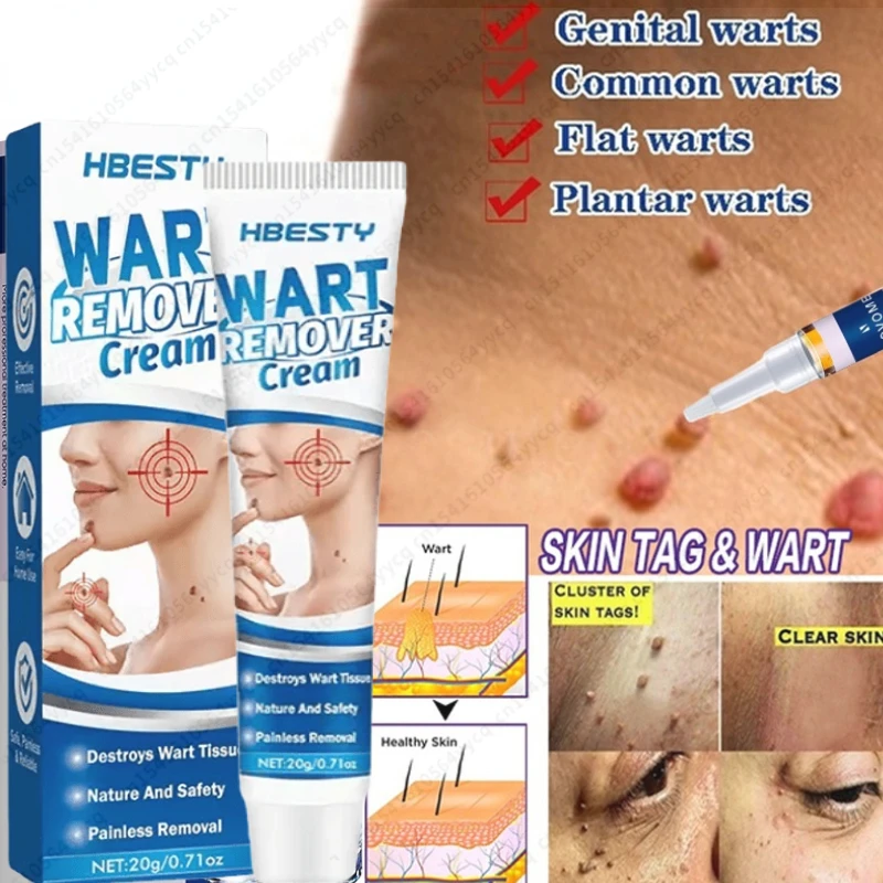 Removing Against Moles Cream Treatment Papillomas Removal Warts Cream From Skin Tags Remover Anti Verruca Remedy Dropshipping
Removing Against Moles Cream Treatment Papillomas Removal Warts Cream From Skin Tags Remover Anti Verruca Remedy Dropshipping
