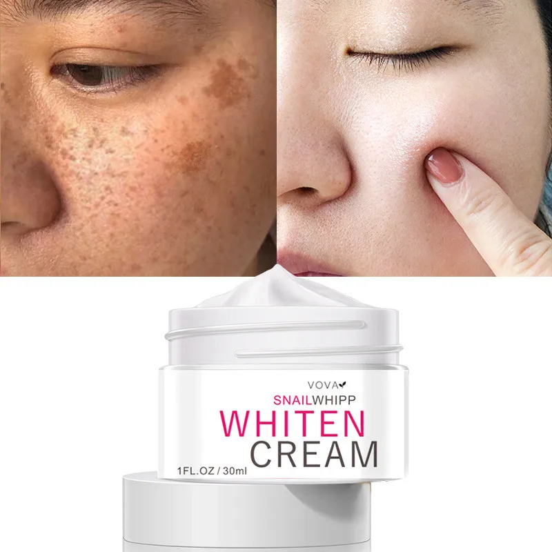 

Whitening Freckle Cream Anti-Aging Remove Melasma Dark Spots Fade Acne Scars Pigmentation Melanin Brightening Moisturizing Skin