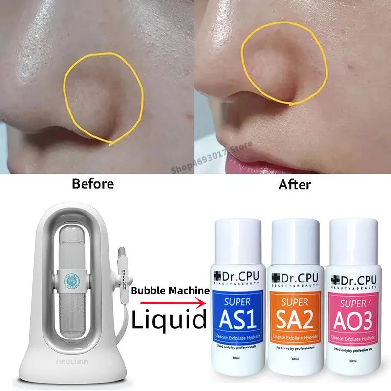 

30ml Concentrated Aqua Peeling Solution AS1 SA2 AO3 Serum For Aqua Peeling Machine Facial SPA Deep Cleansing Beauty Device