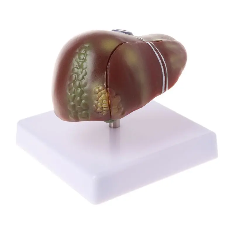Human Liver Pathological Anatomical Model Anatomy School Medical Teaching Displa
Human Liver Pathological Anatomical Model Anatomy School Medical Teaching Displa
