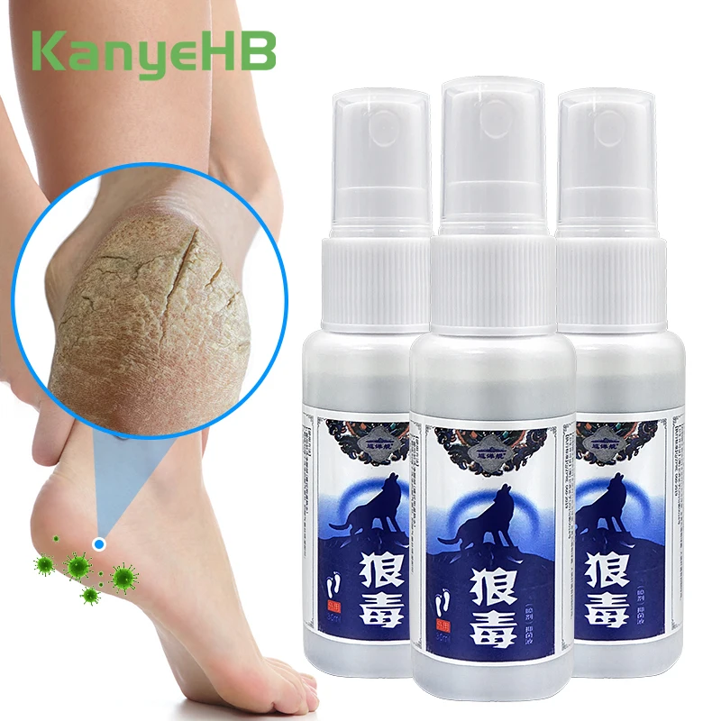 3Pcs Tinea Pedis Athlete's Foot Spray Antibacterial Relief Itch Peeling Healing Medical Spray Removal Foot Odor Foot Care A1402
3Pcs Tinea Pedis Athlete's Foot Spray Antibacterial Relief Itch Peeling Healing Medical Spray Removal Foot Odor Foot Care A1402