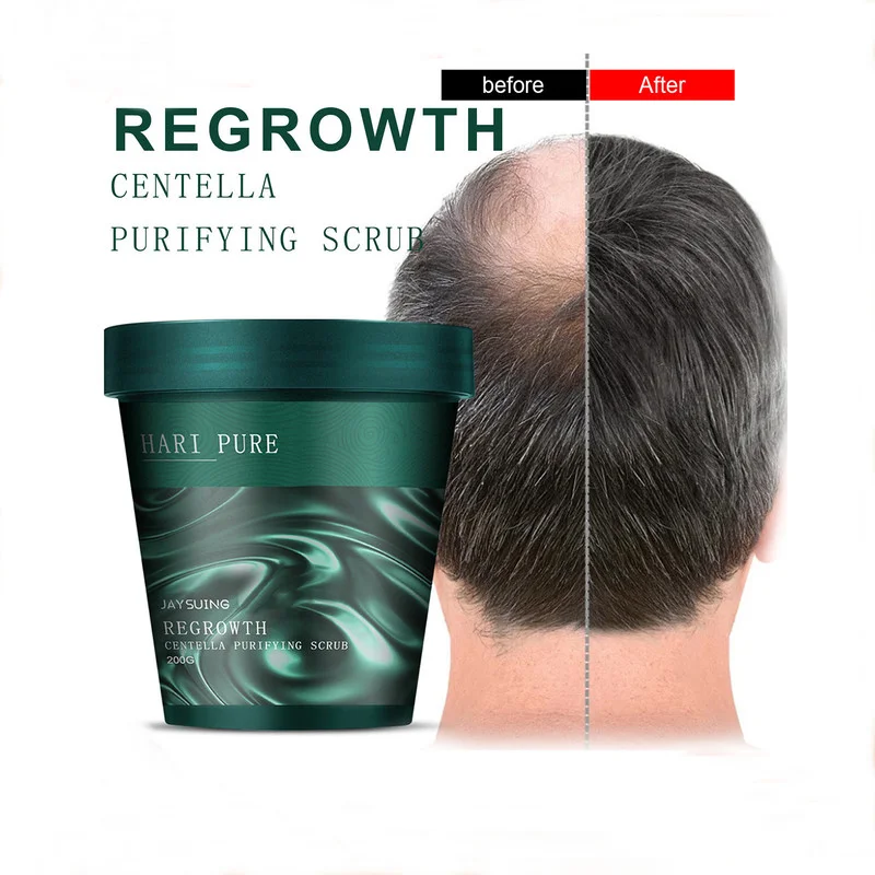 Jaysuing Centella Asiatica Scrub Hair Fall Prevention Baldness Promote Growth Scrub Cleansing Dandruff Relieves Itching
Jaysuing Centella Asiatica Scrub Hair Fall Prevention Baldness Promote Growth Scrub Cleansing Dandruff Relieves Itching