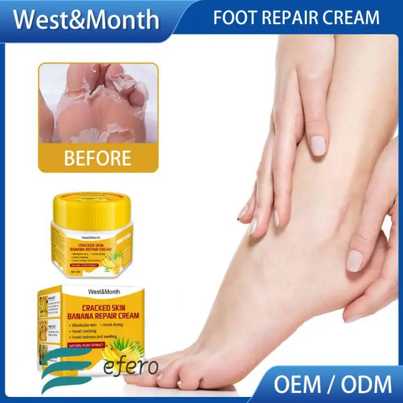 Banana Oil Foot Cream Anti-Drying Crack Heel Cracked Repair Cream Removal Dead Skin Hand Mositurizing Feet Skin Care Foot Mask
Banana Oil Foot Cream Anti-Drying Crack Heel Cracked Repair Cream Removal Dead Skin Hand Mositurizing Feet Skin Care Foot Mask