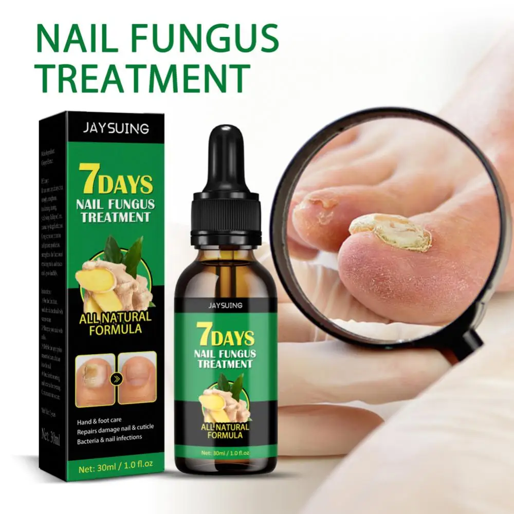 7 Days Ginger Nail Fungal Treat Nail Repair Oil Anti Fungus Nail Liquid Paronychia Onychomycosis Foot Toe Nail Fungus Removal Ge
7 Days Ginger Nail Fungal Treat Nail Repair Oil Anti Fungus Nail Liquid Paronychia Onychomycosis Foot Toe Nail Fungus Removal Ge
