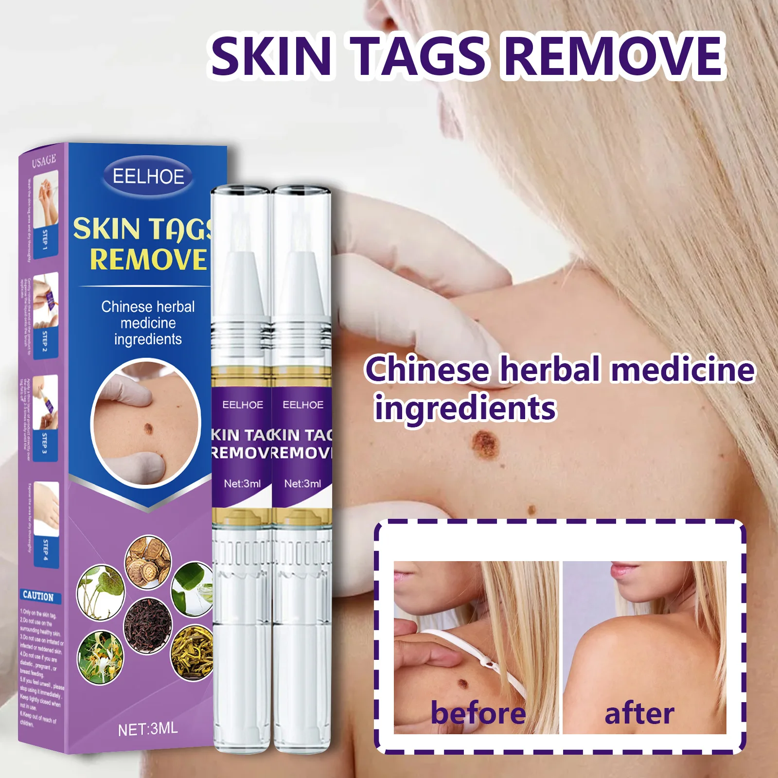 Skin Tag Removal Pen To Lighten The Fleshy Mole Hands Feet Face Meat Particles Neck Skin Cleaning Care Gram Wart Liquid Pen
Skin Tag Removal Pen To Lighten The Fleshy Mole Hands Feet Face Meat Particles Neck Skin Cleaning Care Gram Wart Liquid Pen