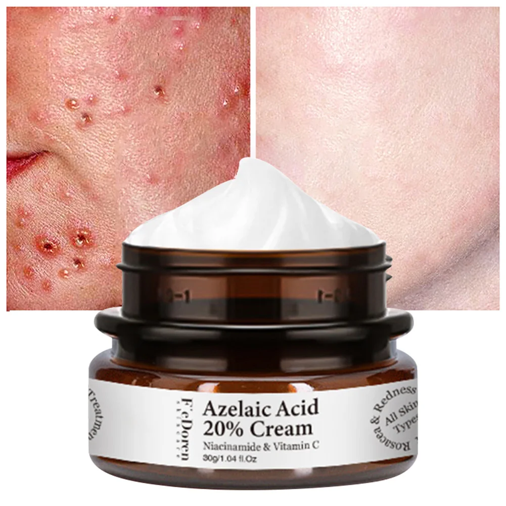 Azelaic Acid 20% Whitening Fades Acne Cream Freckle Remove Melasma Dark Pigment Spots Melanin Alpha Arbutin Face Cream Skin Care
Azelaic Acid 20% Whitening Fades Acne Cream Freckle Remove Melasma Dark Pigment Spots Melanin Alpha Arbutin Face Cream Skin Care