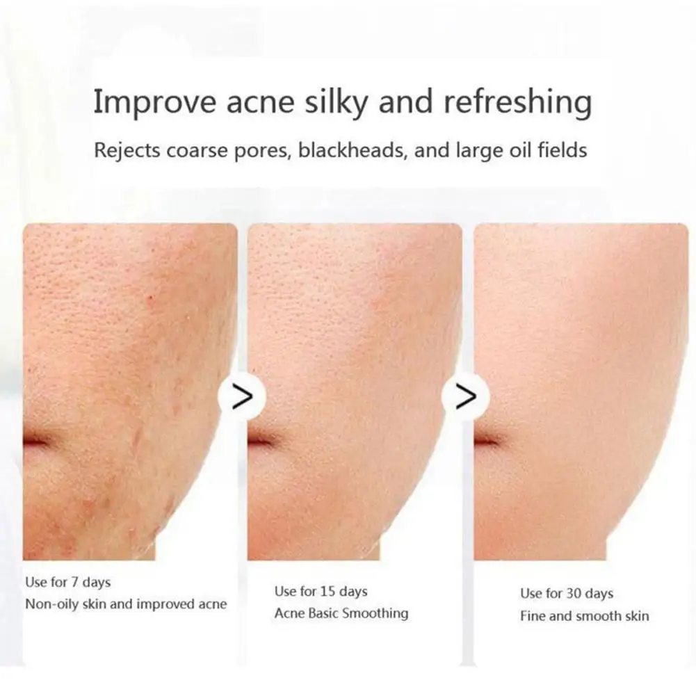 30g Retinol Face Wash Soap Collagen Face Cream Anti Pores Lifting Soap Cleansing Wrinkle Moisturizing Firm Shrink Whitening T2y1
30g Retinol Face Wash Soap Collagen Face Cream Anti Pores Lifting Soap Cleansing Wrinkle Moisturizing Firm Shrink Whitening T2y1