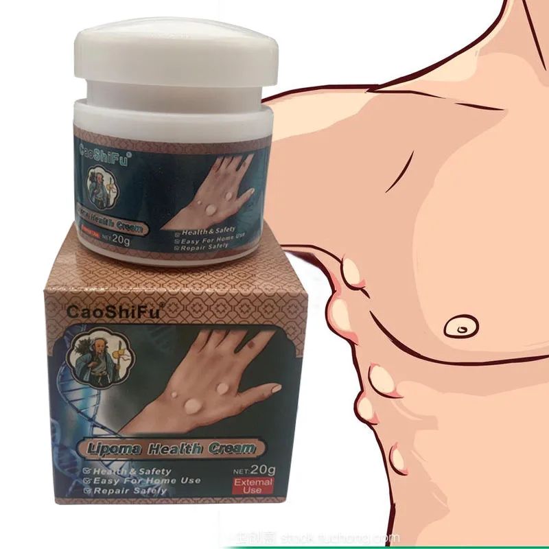 ZB Lipoma Removal Cream Antitumor Remove Fat Lump Ointment Nodular Discomfort Skin Cyst Swelling Pain Relief Herbs Plaster Care
ZB Lipoma Removal Cream Antitumor Remove Fat Lump Ointment Nodular Discomfort Skin Cyst Swelling Pain Relief Herbs Plaster Care