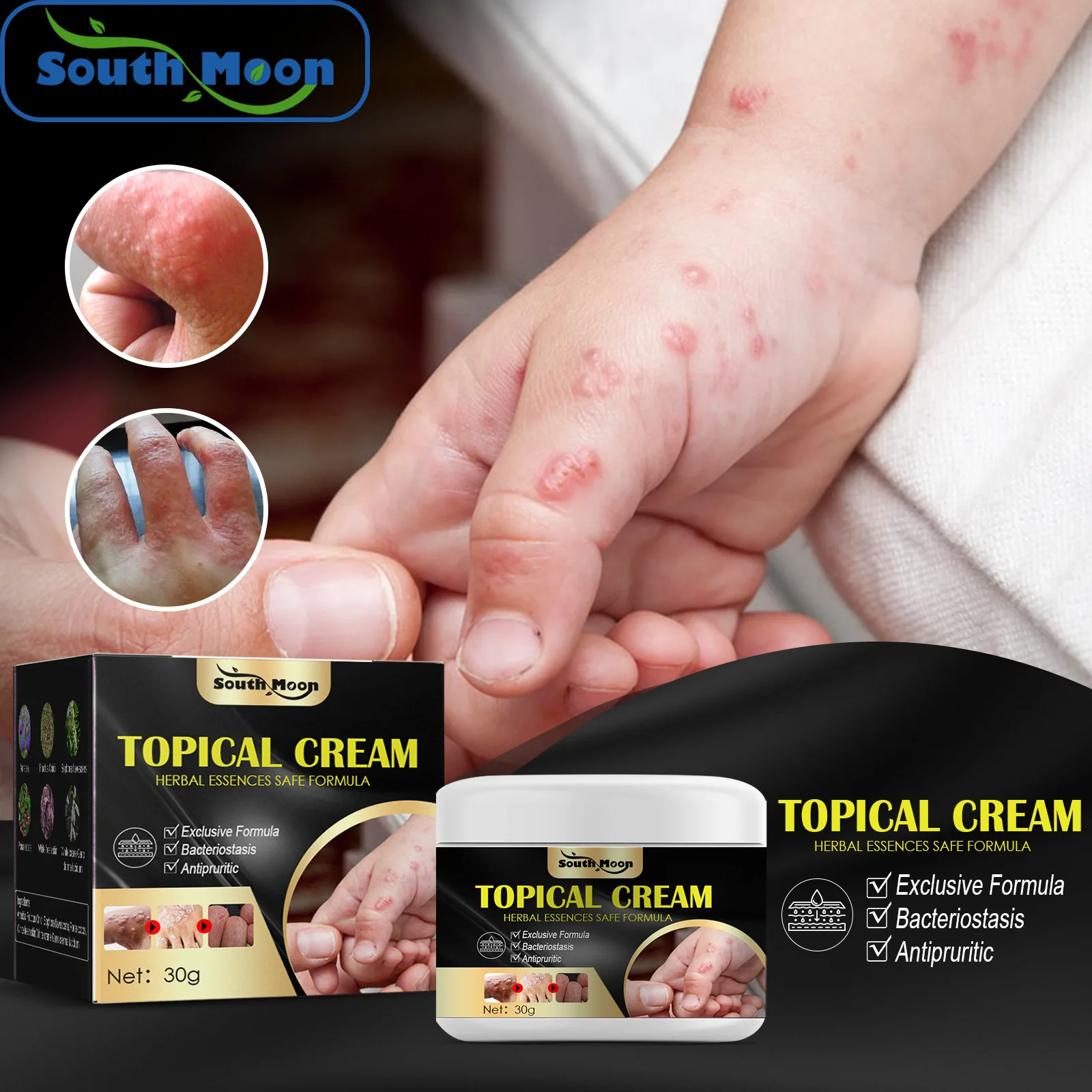 Hand and foot antipruritic cream, dry skin, itching, itching, mosquito bites, and antipruritic cream
Hand and foot antipruritic cream, dry skin, itching, itching, mosquito bites, and antipruritic cream