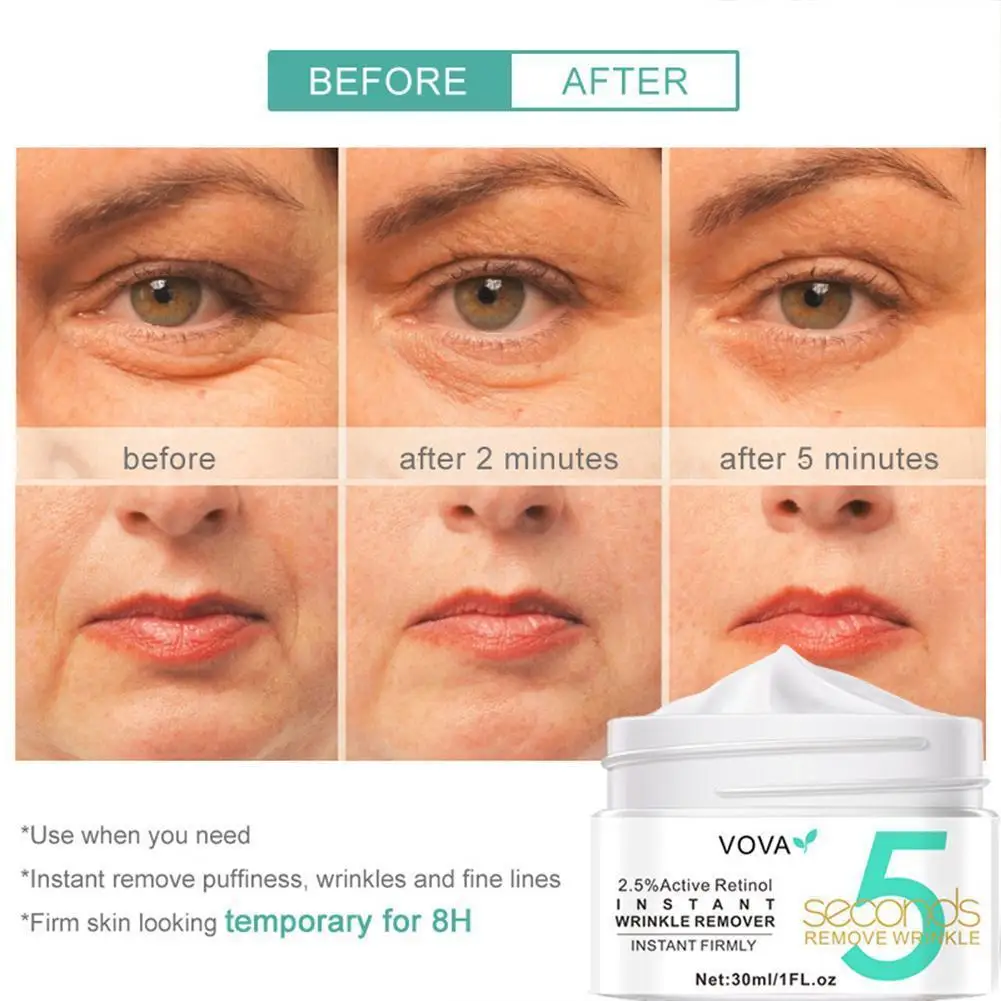 Retinol Eye Cream Wrinkle Cream 5 Seconds Remove Dark Aging Circles Skin Puffy Care Beauty Makeup Remove Eyes Lifting Firm Q9n4
Retinol Eye Cream Wrinkle Cream 5 Seconds Remove Dark Aging Circles Skin Puffy Care Beauty Makeup Remove Eyes Lifting Firm Q9n4