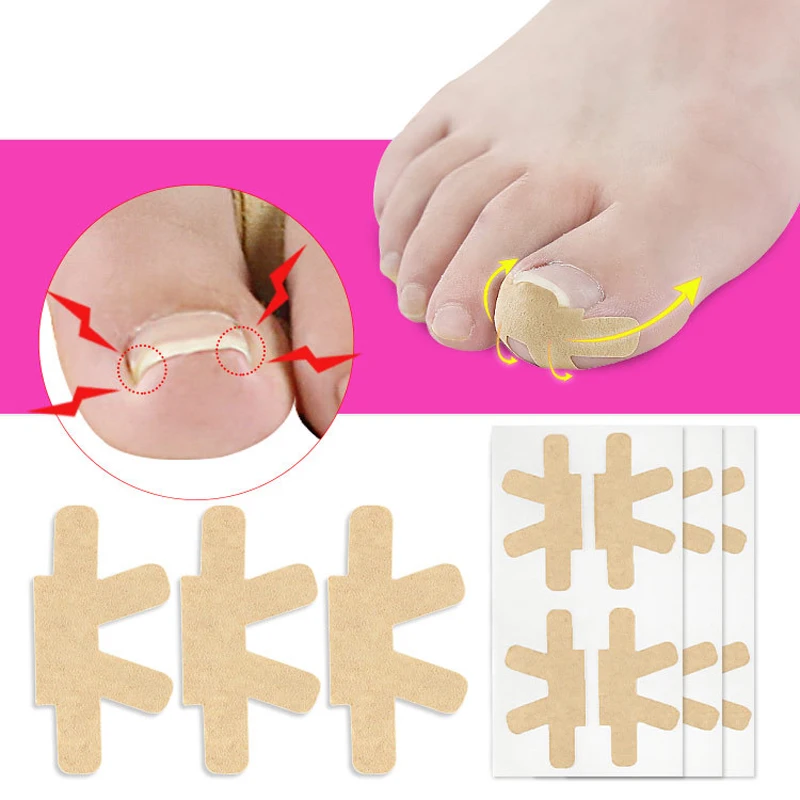 20-4PCS Ingrown Toenail Correction Pad Tool Ingrown Toe Nail Stickers Elastic Patch Straightening Clip Brace Pedicure Tools
20-4PCS Ingrown Toenail Correction Pad Tool Ingrown Toe Nail Stickers Elastic Patch Straightening Clip Brace Pedicure Tools