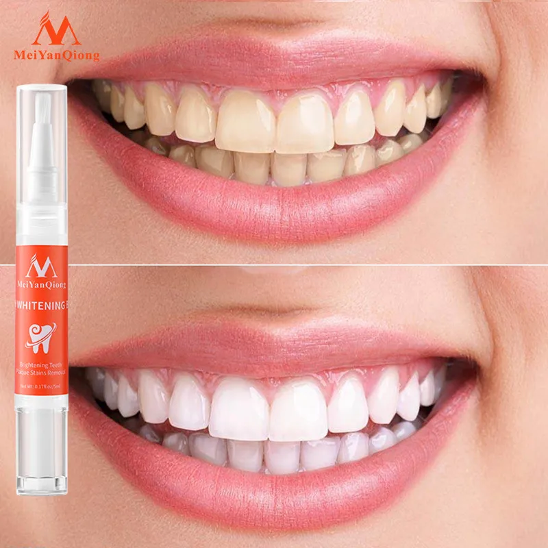 Teeth Whitening Pen Remove Plaque Stains Tooth Gel Whitener Bleach Remove Yellowing Brighten Gently Whiten Teeth Fresh Breath
Teeth Whitening Pen Remove Plaque Stains Tooth Gel Whitener Bleach Remove Yellowing Brighten Gently Whiten Teeth Fresh Breath
