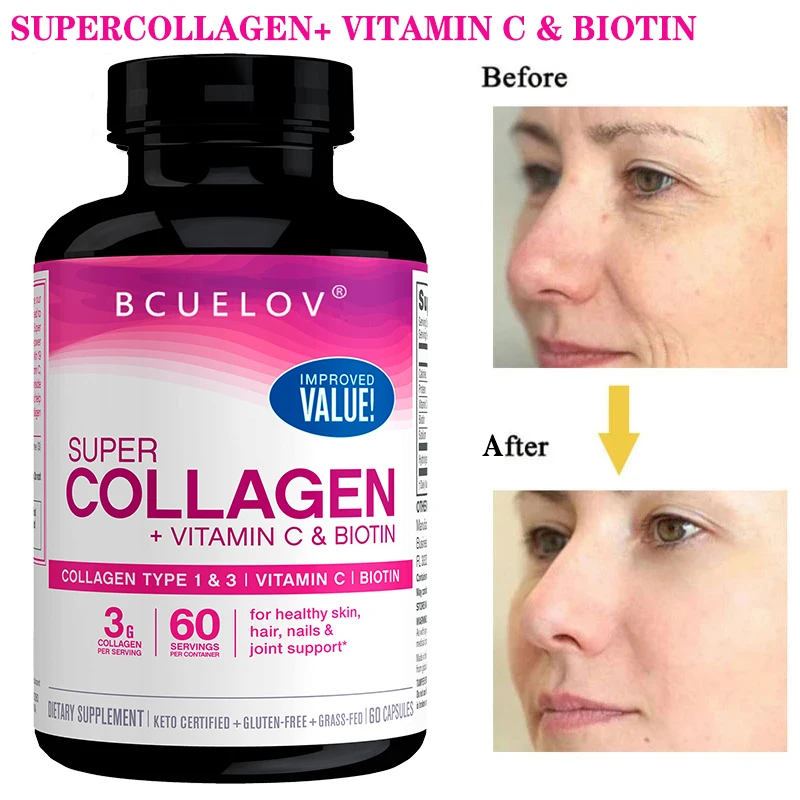 Super Collagene + Biotina Supporto Per La Salute Di Pelle, Unghie, Capelli E Vitamina C Integratori Alimentari
Super Collagene + Biotina Supporto Per La Salute Di Pelle, Unghie, Capelli E Vitamina C Integratori Alimentari