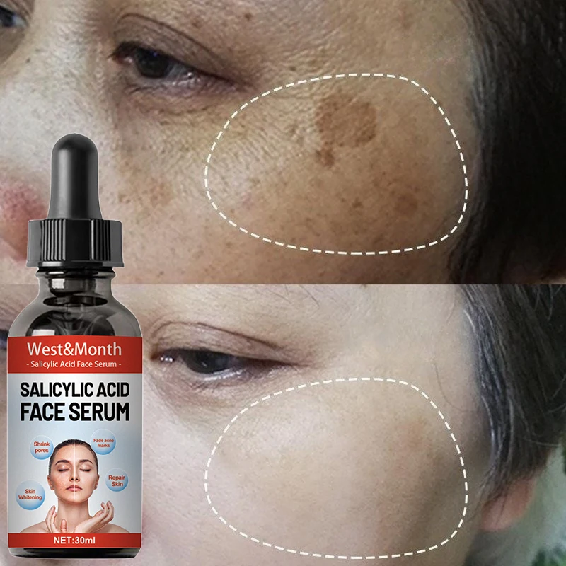 

Whitening Freckles Face Serum Remove Dark Spots Fade Melasma Acne Scar Lighten Melanin Essence Oil Anti-aging Brighten Skin Care