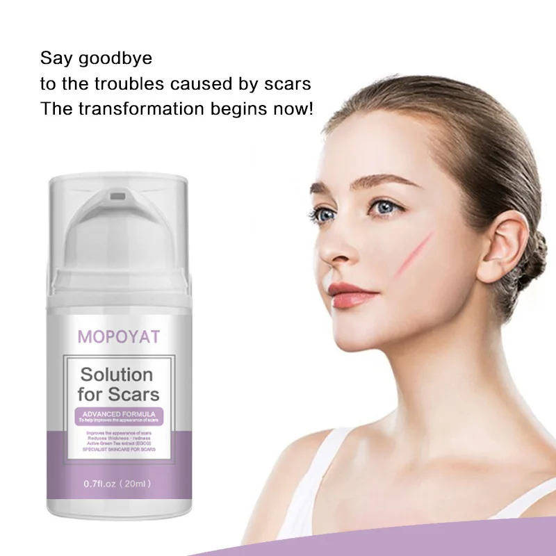 Scar Remover Gel for Scars from C-Section, Stretch Marks, Acne, Surgery, Effective for both Old and New Scars
Scar Remover Gel for Scars from C-Section, Stretch Marks, Acne, Surgery, Effective for both Old and New Scars