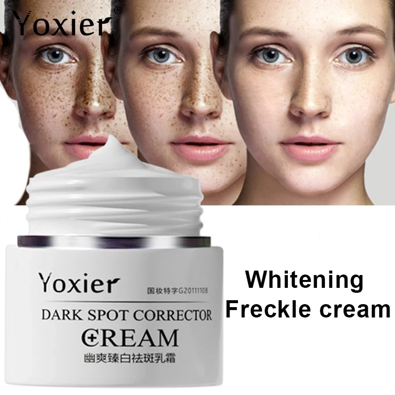Face Dark Spot Correction Cream Remove Spots Pigmentation Face Cream Uneven Skin Tone Whitening Brightening Body Skin Care 30g
Face Dark Spot Correction Cream Remove Spots Pigmentation Face Cream Uneven Skin Tone Whitening Brightening Body Skin Care 30g