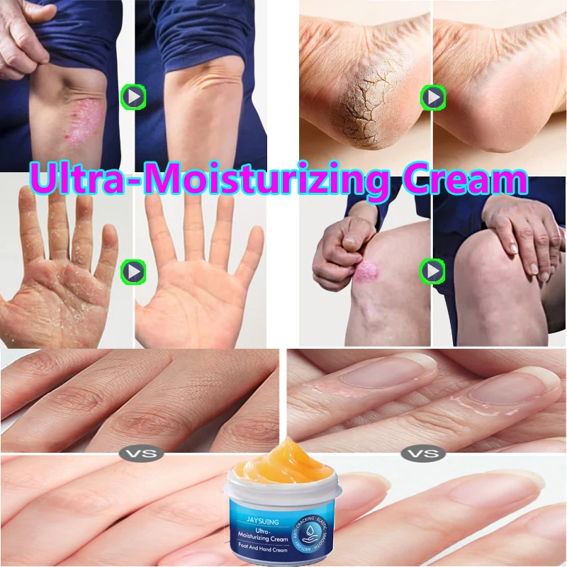 Anti-crack Repair Hand Cream to Improve Crack Rough Skin to Remove Dead Skin Hydrating Moisturizing Hand and Foot Body Creams
Anti-crack Repair Hand Cream to Improve Crack Rough Skin to Remove Dead Skin Hydrating Moisturizing Hand and Foot Body Creams