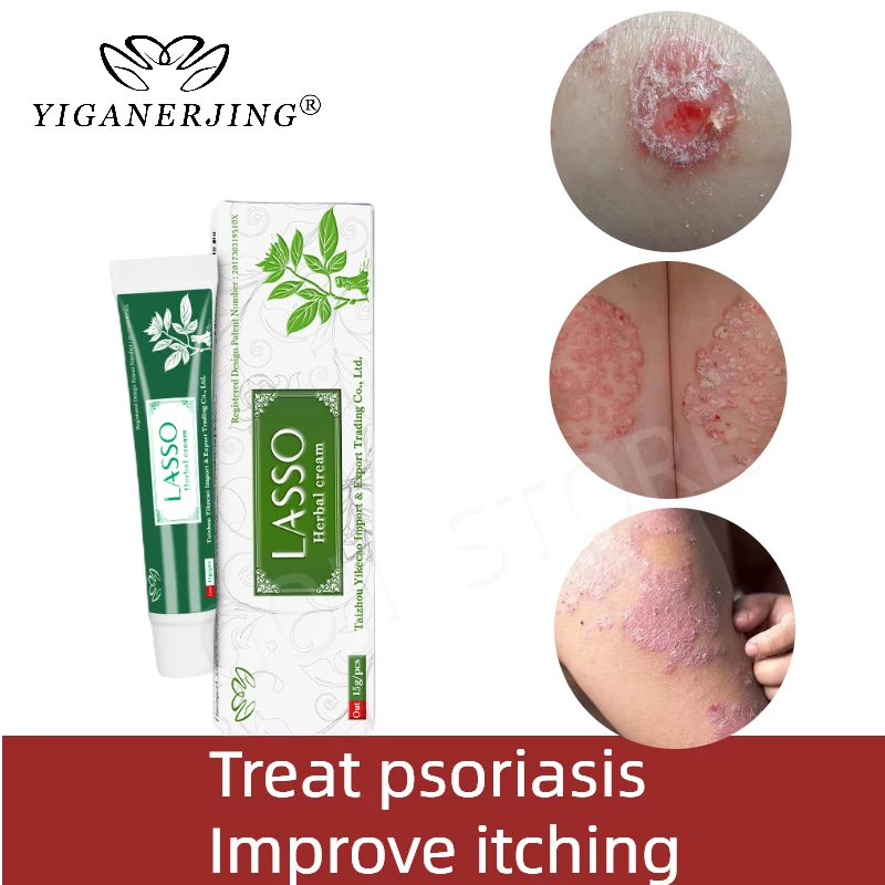 10pcs Lasso Natural Skin Care Cream Dermatitis Eczematoid Eczemas Ointments Psoriasis Treatment Medical Care Cream YIGANERJING
10pcs Lasso Natural Skin Care Cream Dermatitis Eczematoid Eczemas Ointments Psoriasis Treatment Medical Care Cream YIGANERJING