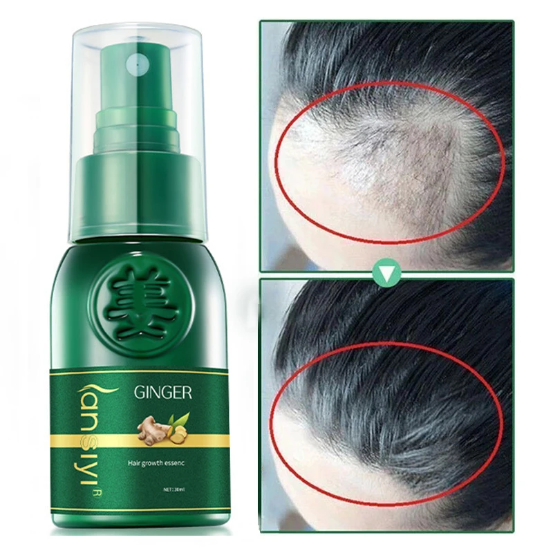 

Ginger Anti-hair Loss Hair Liquid Natural Plant Essence Fast Growth Beard Eyelash Hair Growth Spray Hair Loss Hair Care Essence