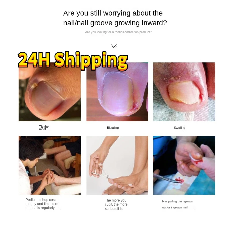 12 Pieces Improve Toenail Groove Relief Patch Nail Painless Corrective Patch Toe Nail Sticker for Foot Skin Care Tools Health
12 Pieces Improve Toenail Groove Relief Patch Nail Painless Corrective Patch Toe Nail Sticker for Foot Skin Care Tools Health