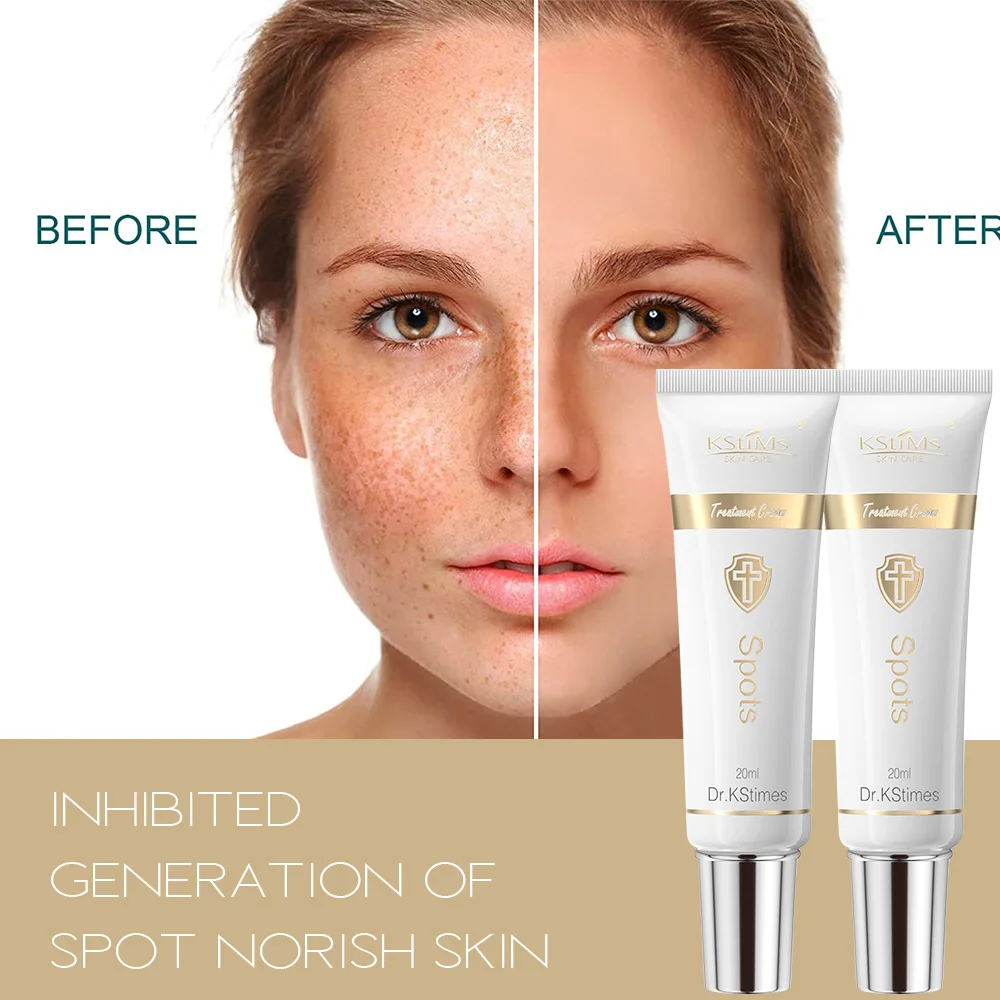 

Aravia Professional Expigment Dark Spot Remover Cream Anti Melasma Pigmentation Removal Whitening Freckle Cream for Face Spots