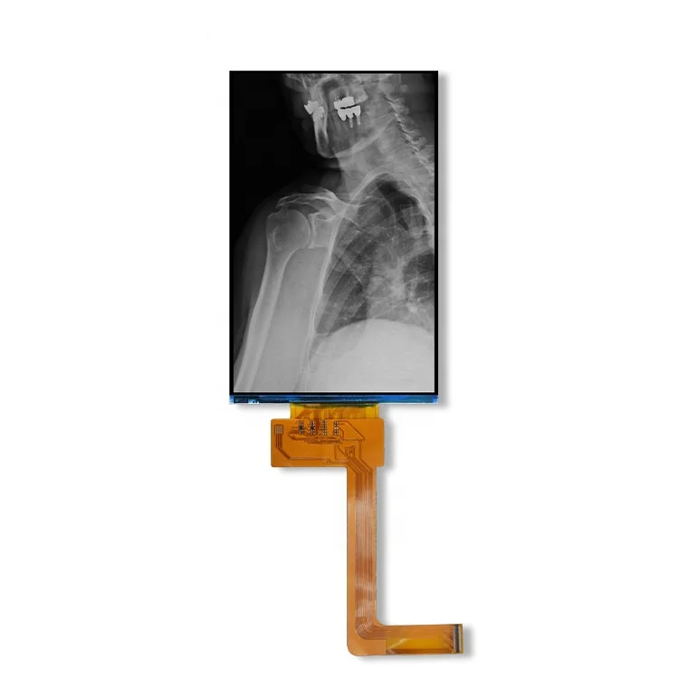 6 Inch 2K MONO Chrome LCD Display 1620*2560 Resolution With Driver Board Application For 3D Printer SLA/DLP Dental X-Ray Machine
6 Inch 2K MONO Chrome LCD Display 1620*2560 Resolution With Driver Board Application For 3D Printer SLA/DLP Dental X-Ray Machine