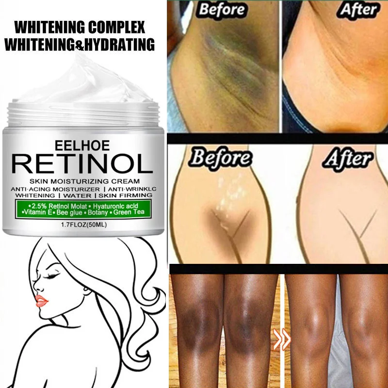 Body Whitening Cream Underarm Knee Buttocks Private Remove Pigmentation Melanin Improve Body Dull Moisturizer Brighten Skin Care
Body Whitening Cream Underarm Knee Buttocks Private Remove Pigmentation Melanin Improve Body Dull Moisturizer Brighten Skin Care