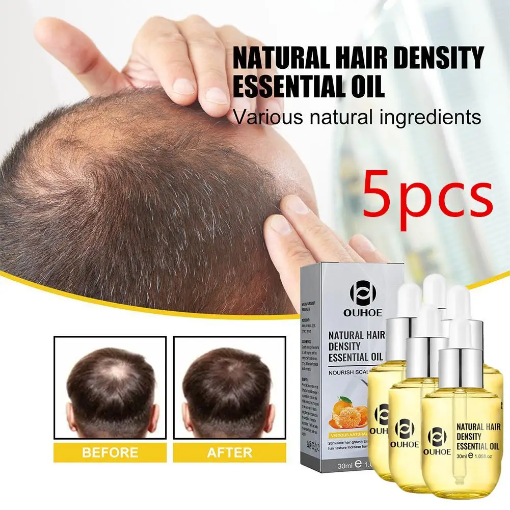 5pc/30ml Ginger Essential Oil Natural Hair Density Anti Prevent Lose Liquid Regrowth Fast Growth Serum Beauty
5pc/30ml Ginger Essential Oil Natural Hair Density Anti Prevent Lose Liquid Regrowth Fast Growth Serum Beauty